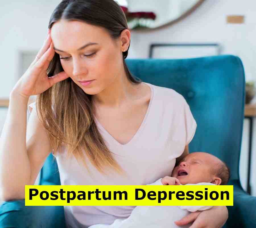 Postpartum Depression (1)
